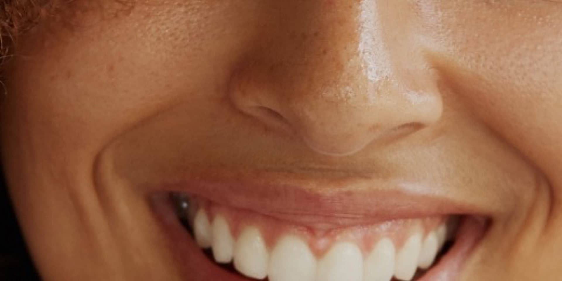Healthy confident smile